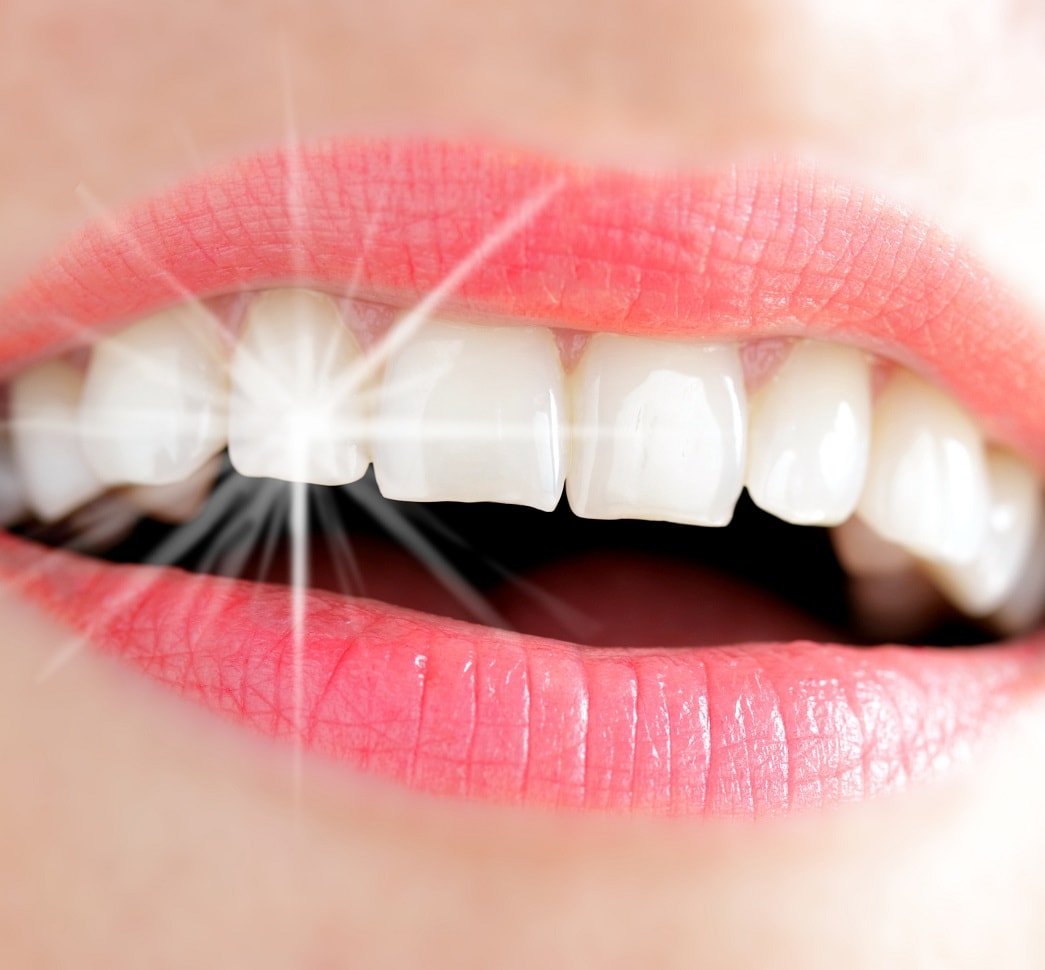 Sbiancamento Denti