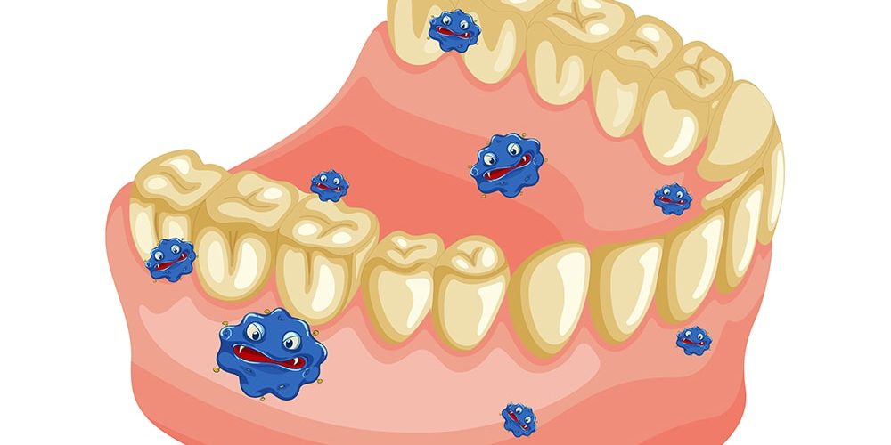 placca-dentale placca-dentale