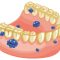 placca-dentale