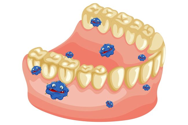 placca-dentale